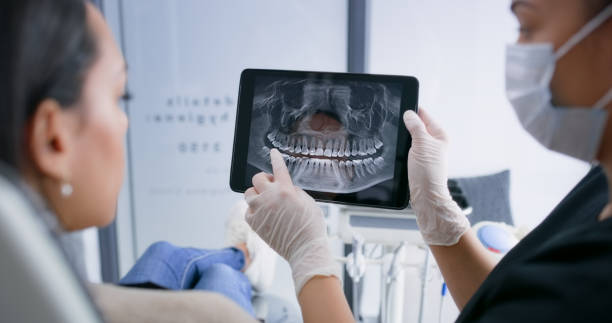 Licensed Teeth Whitening service in China, TX - Smile Center Dentistry